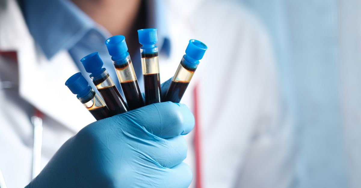 ApoB: The Most Important Cholesterol Number You're Not Tracking