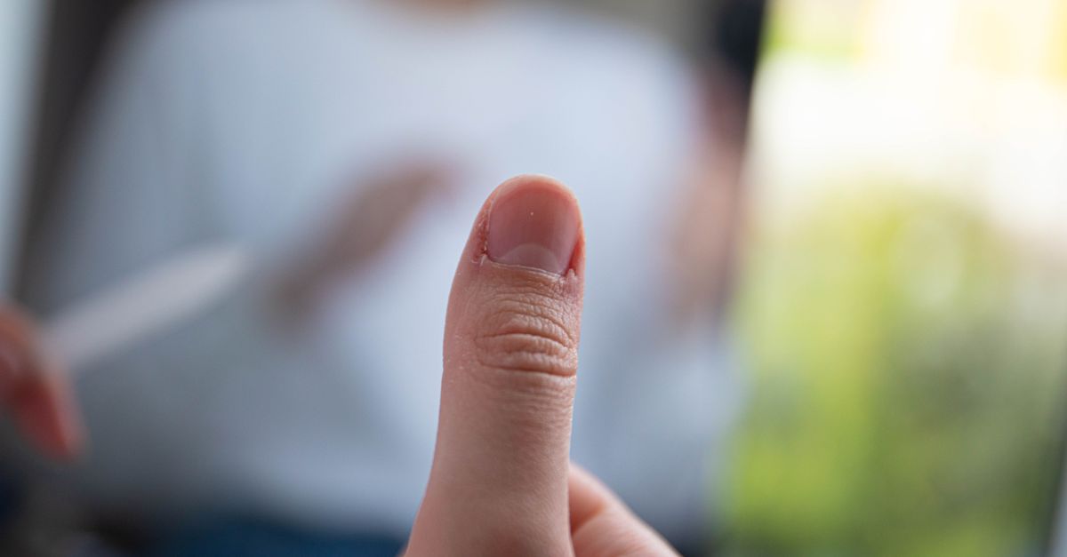 Are Brittle Nails Normal During a Heavy Period?