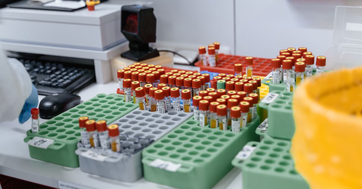 Blood Biomarkers for Supplement Personalization: The Complete Guide