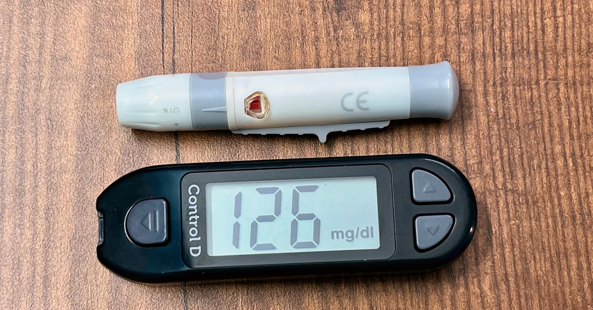 Continuous Glucose Monitor for Non-Diabetics: How to Read Your Spikes and Supplement Around Them