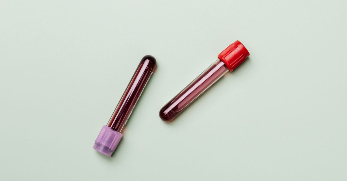 What the Research Actually Says About How Fast Can I Lower Triglycerides?