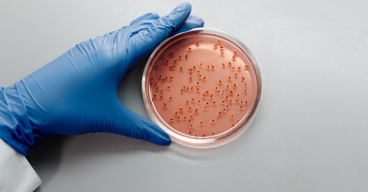How Much Probiotics Do You Need for PCOS?