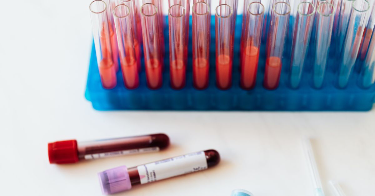 hs-CRP: The Inflammation Marker That Predicts Heart Attacks