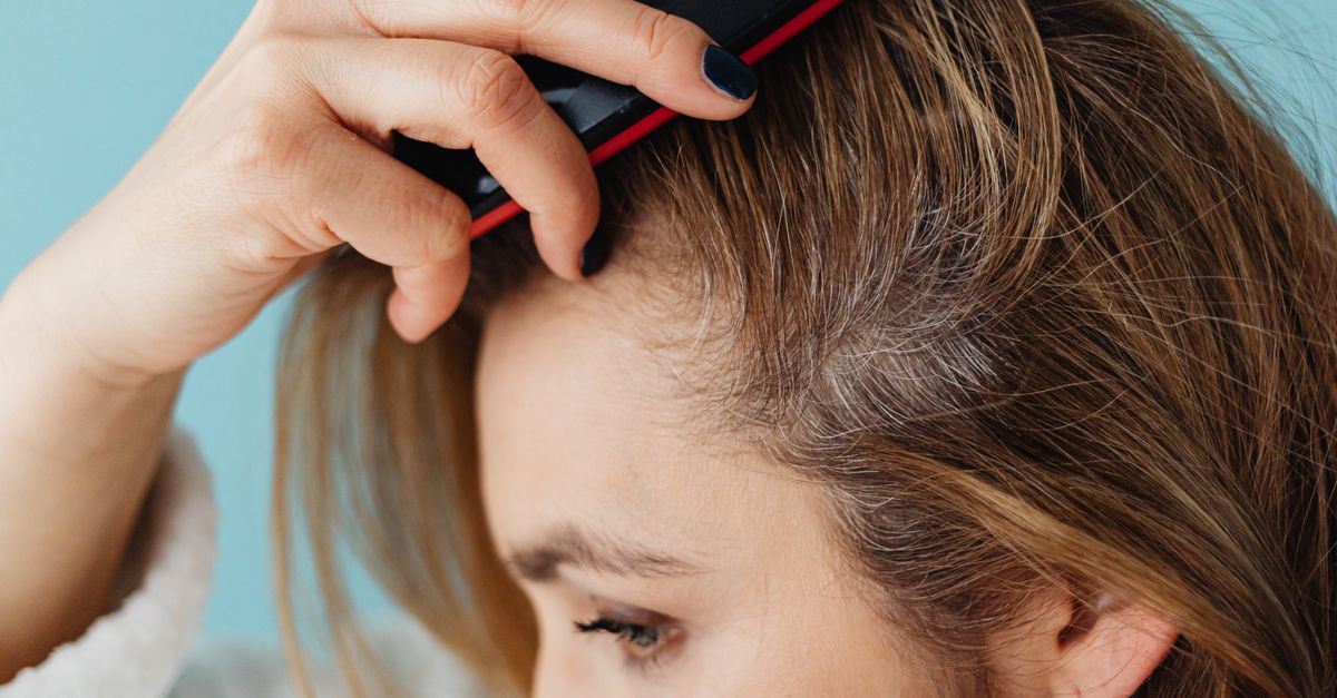 Is Hair Thinning Normal with Endometriosis?