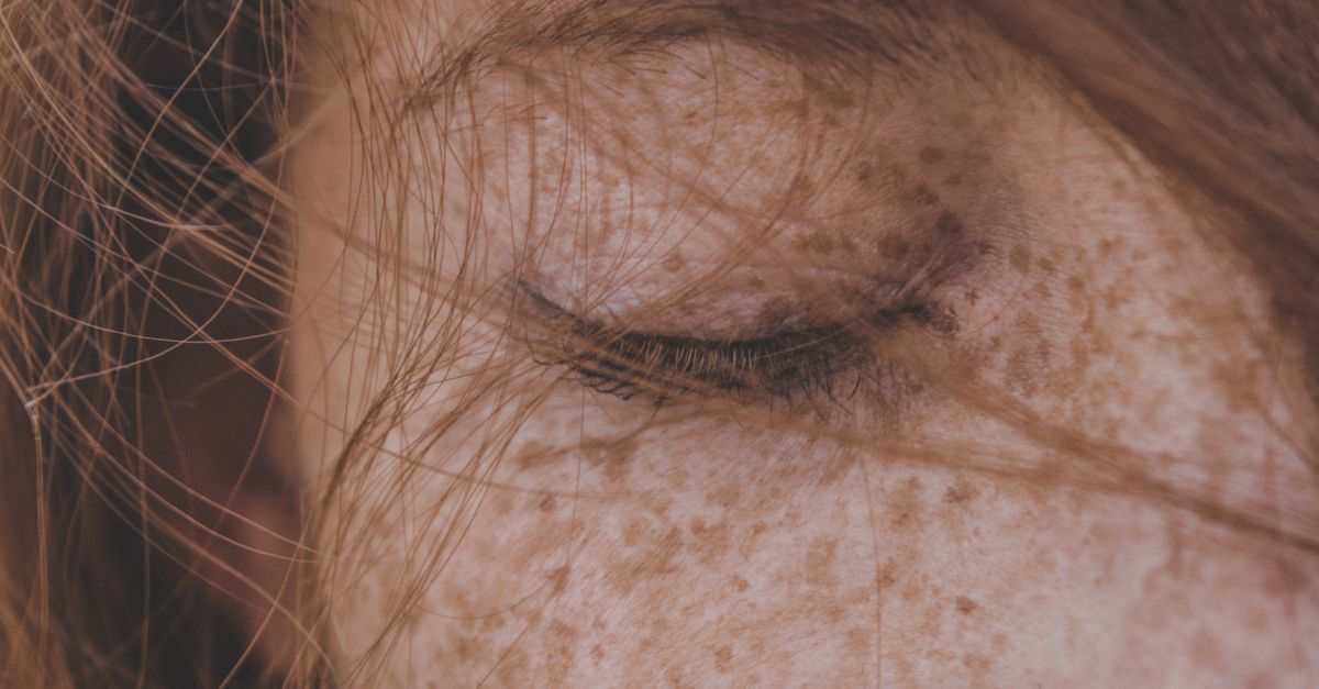 Is Itchy Skin Normal in Postmenopause?