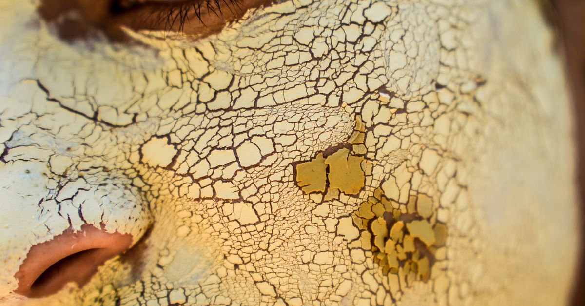 Is Itchy Skin Normal in Perimenopause with Hypothyroidism?