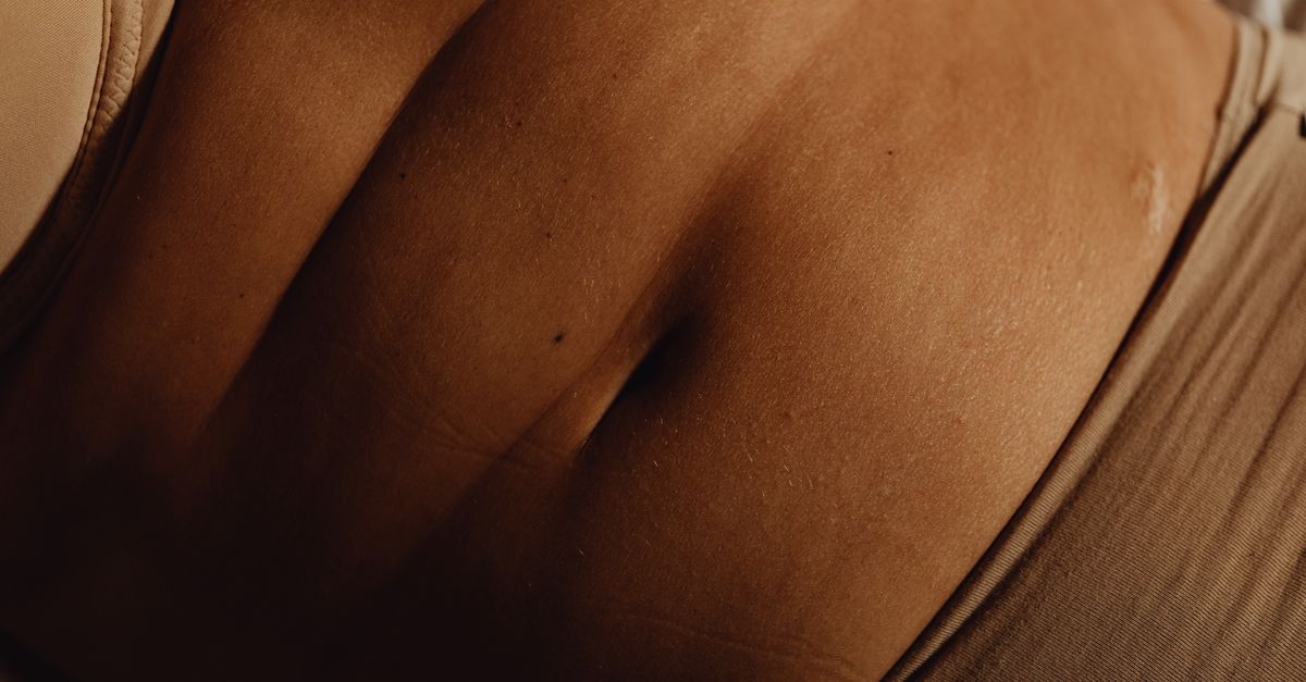 Is Thinning Skin Normal with Fibroids?