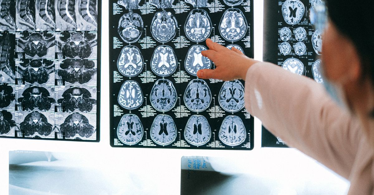 Why Magnesium L-Threonate Overdose Symptoms Happen — and What Nutrient Gaps May Be Driving It