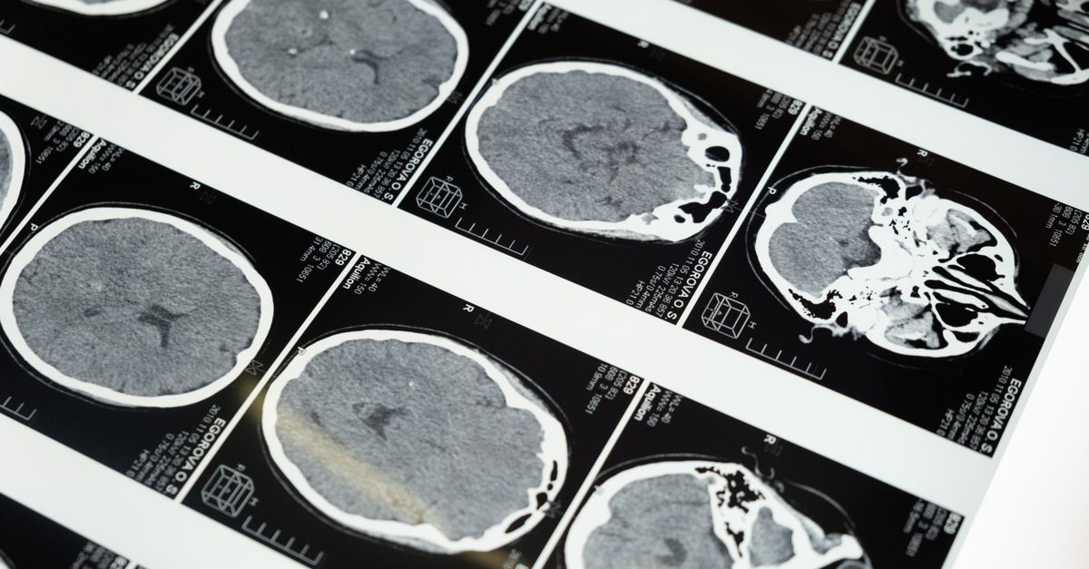 What the Research Actually Says About Mr. Happy Stack (Citicoline + Uridine + DHA) — Does It Actually Sharpen Focus and Recall?