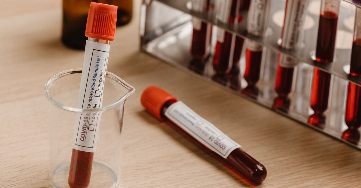 What Is an Optimal Fasting Insulin Level?: Why "In Range" Isn't Always "Optimal"
