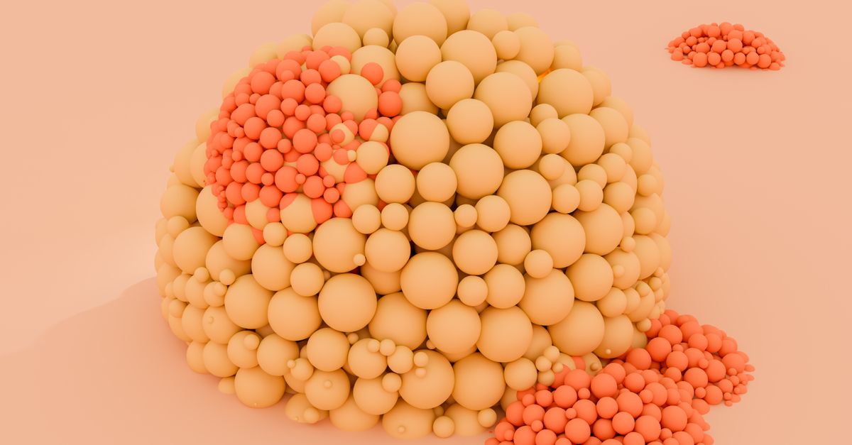 Why Do PCOS Symptoms Change Week to Week?