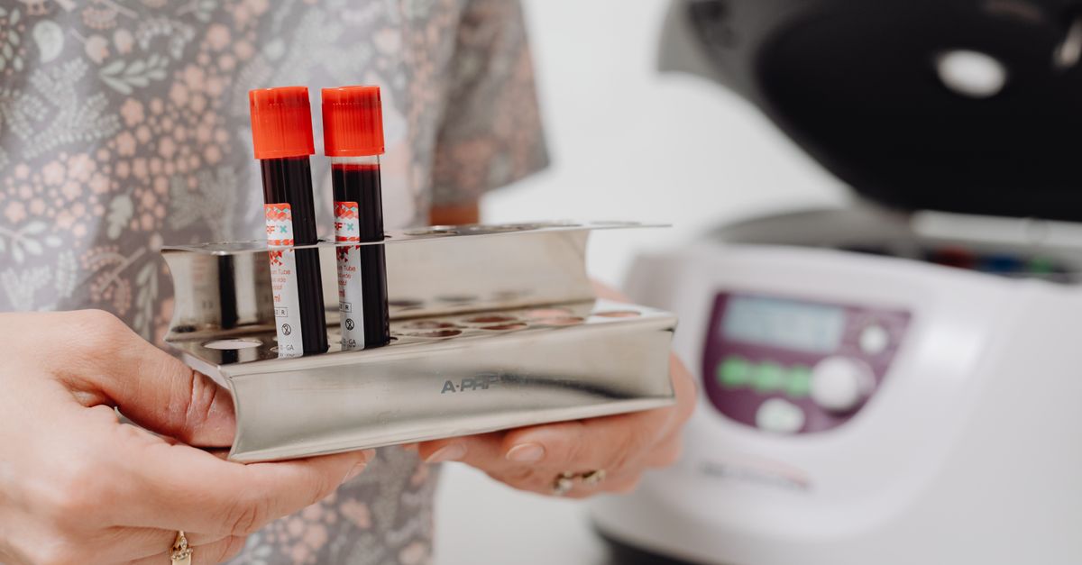 Understanding What Causes Cholesterol Ratio to Be Out of Range on Your Lab Report