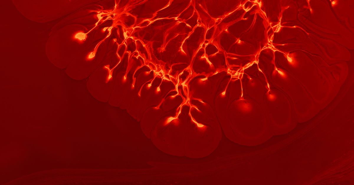 What Causes Food Sensitivity with Endometriosis?