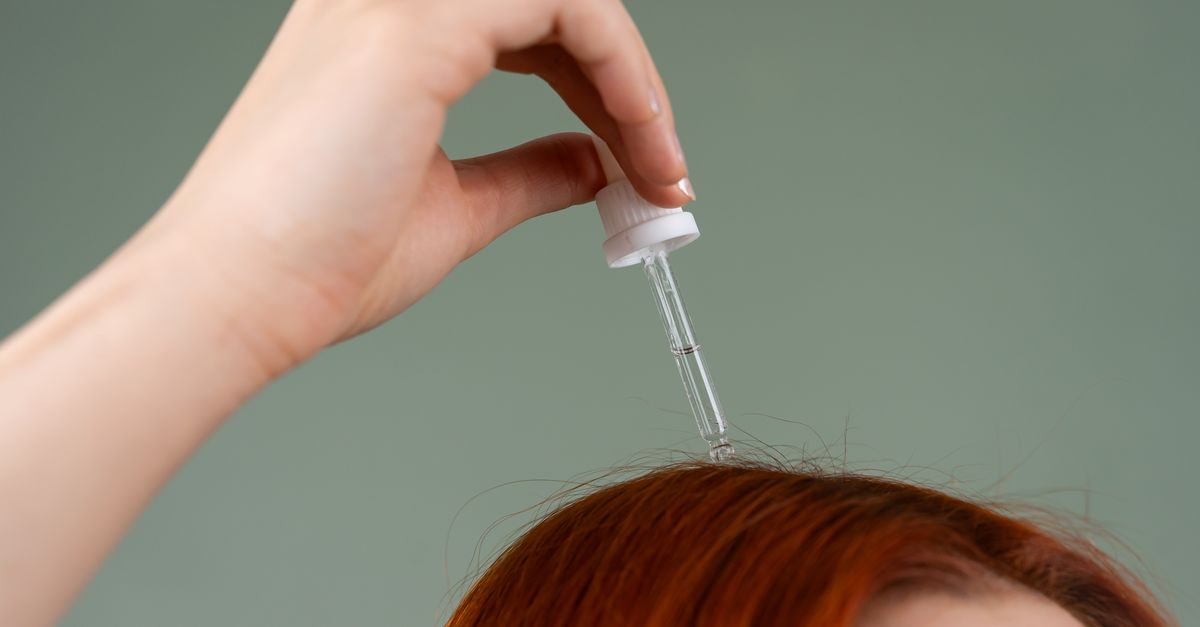 What Causes Hair Thinning with PCOS?