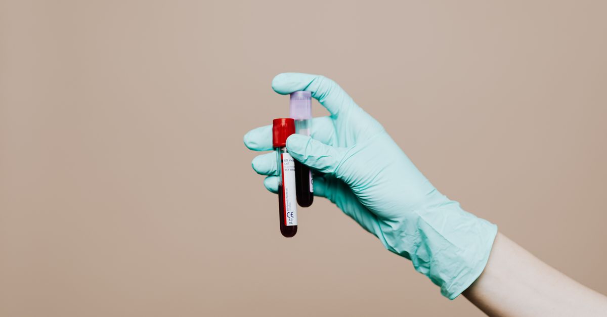 What Causes HDL to Be Out of Range?: A Functional-Medicine Interpretation Guide