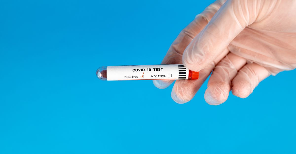 What Causes High CRP?: How to Read the Number and What to Do About It
