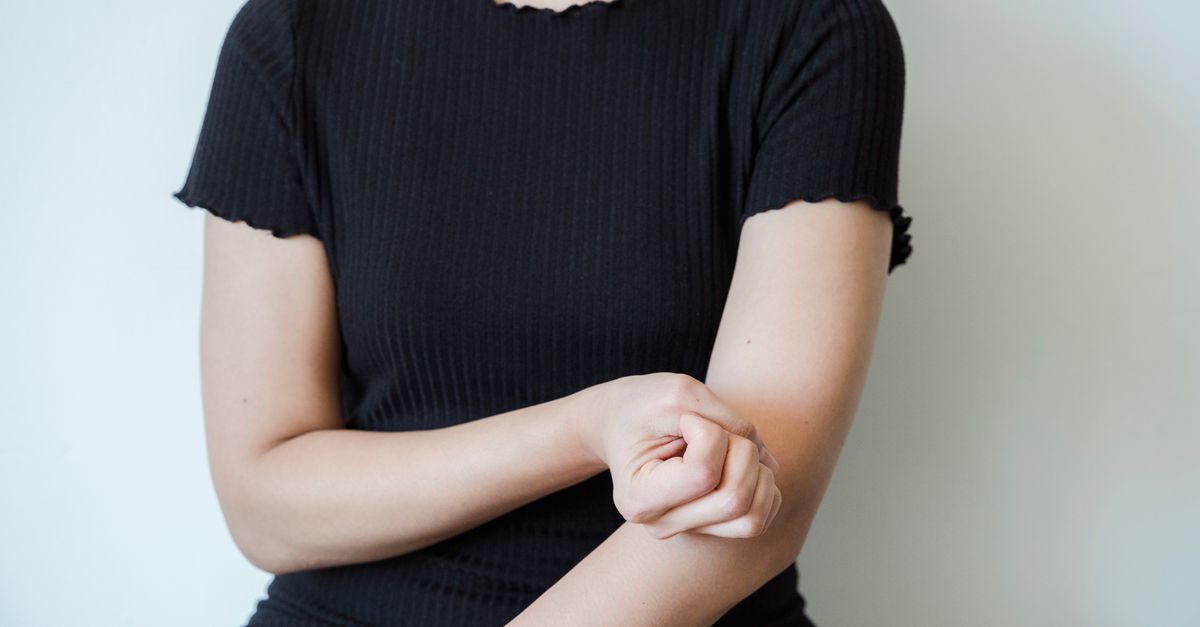 What Causes Itchy Skin in PCOS?
