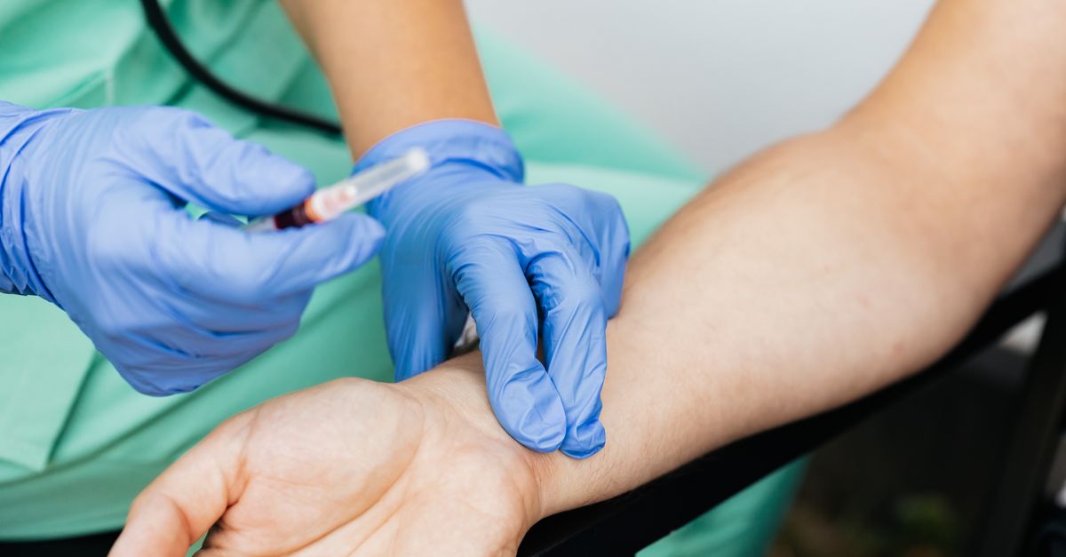 What Causes Low Ferritin in Women?