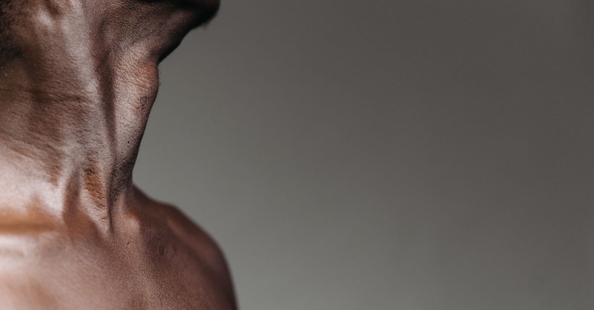 What Causes Muscle Loss with PCOS?
