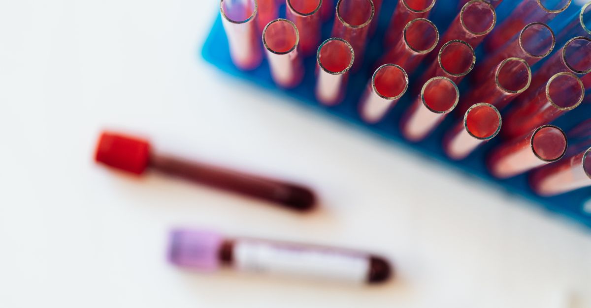 What Does CRP Tell You About Your Hormones?