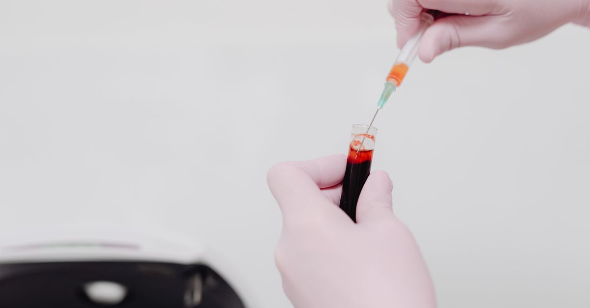 What Does LDL Cholesterol Actually Measure? A Look at the Clinical Evidence