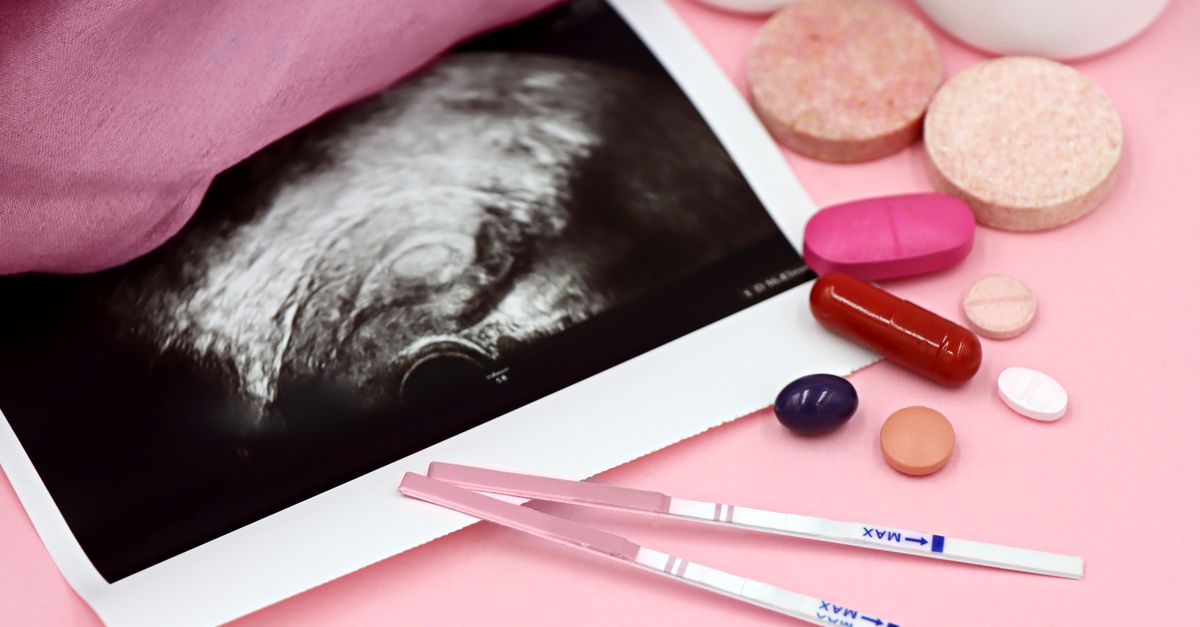 What Happens to Cortisol in PCOS?