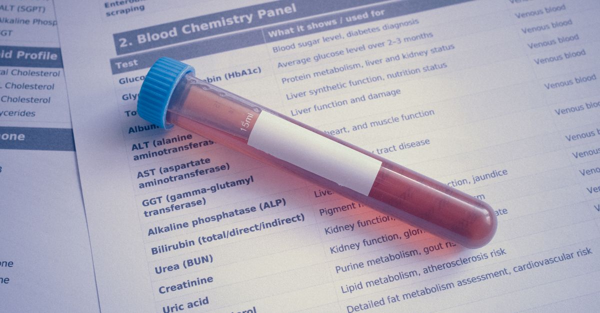 What Is a Normal ApoB Level?: A Functional-Medicine Interpretation Guide