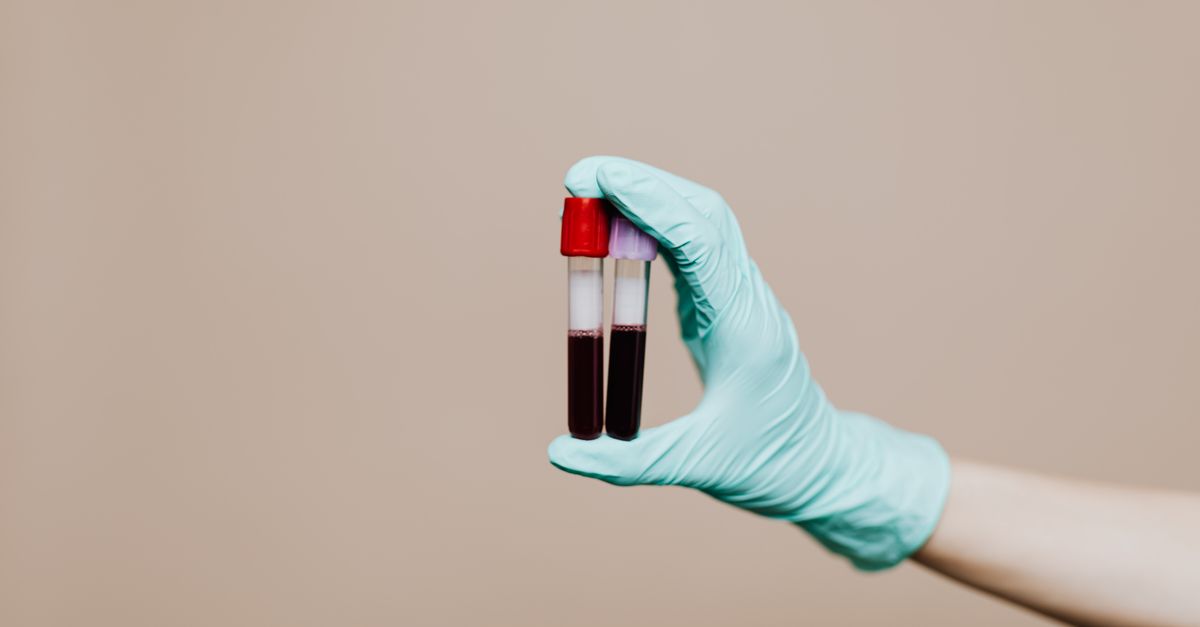 What Is a Normal CRP Level?: A Functional-Medicine Interpretation Guide