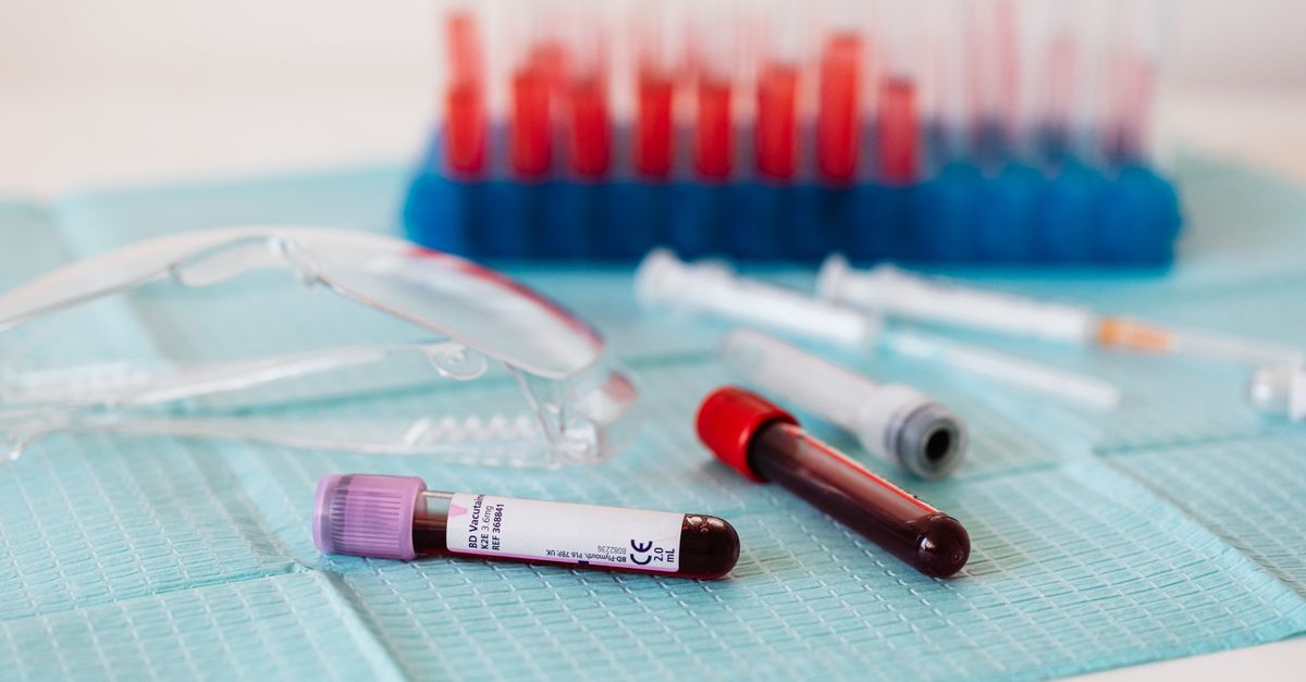 What Is a Normal ESR Level?: Optimal Ranges, Warning Signs, and Targeted Support