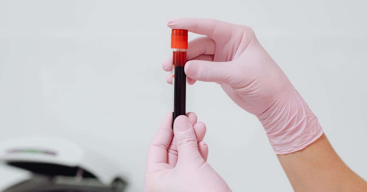 What Is a Normal Ferritin Level in PCOS?
