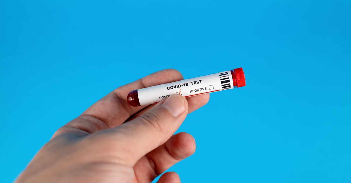 What Is a Normal HDL Level?: Optimal Ranges, Warning Signs, and Targeted Support