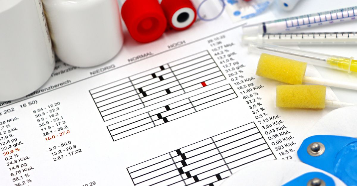 What Is a Normal Triglycerides Level?: Optimal Ranges, Warning Signs, and Targeted Support