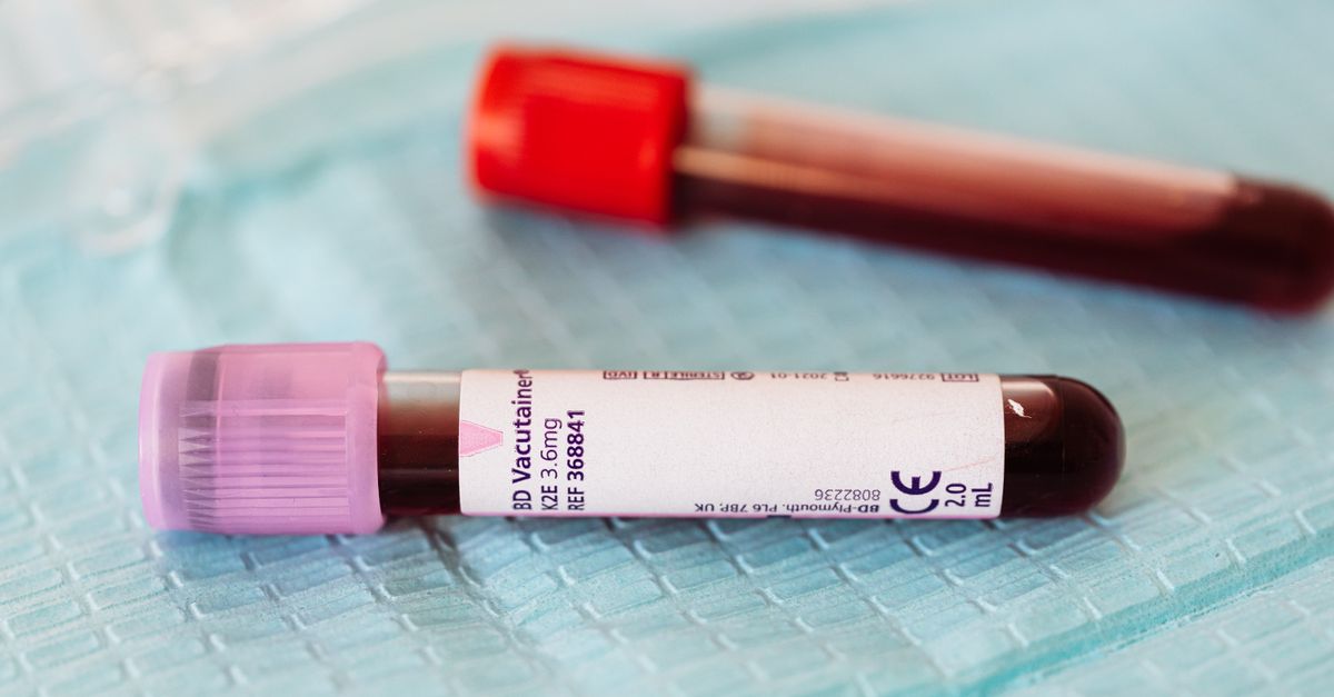 Why Are My Thyroid Antibodies Borderline? A Clinical Look at What the Evidence Says